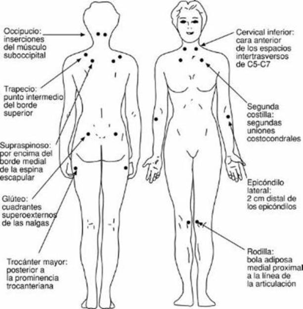 la fibromialgia-01