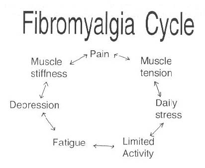 la fibromialgia